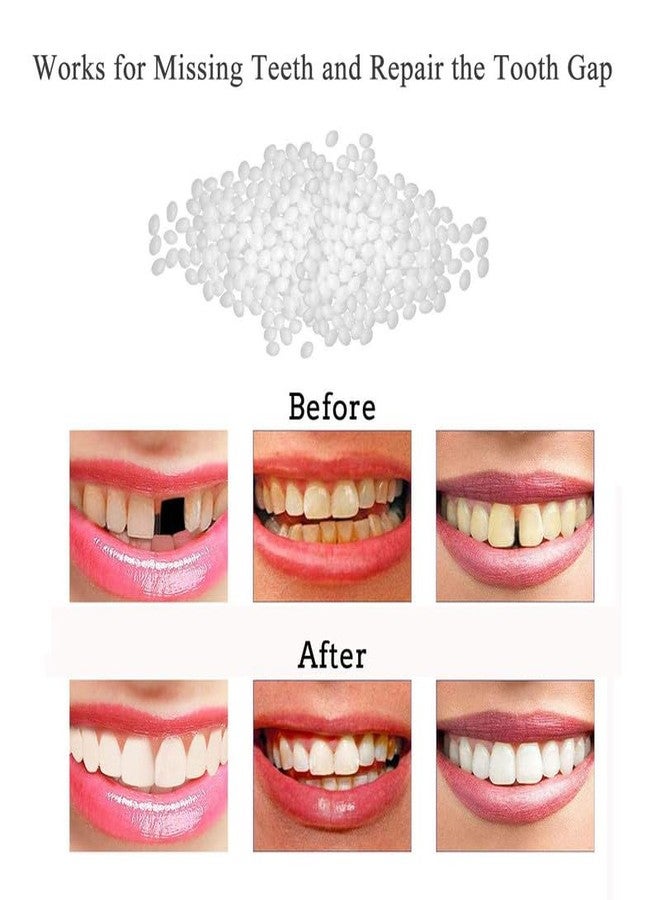 mr.fix Mr Fix® Temporary Moldable Teeth Fix 20g - At-Home Dental Repair Pellets - Image 5